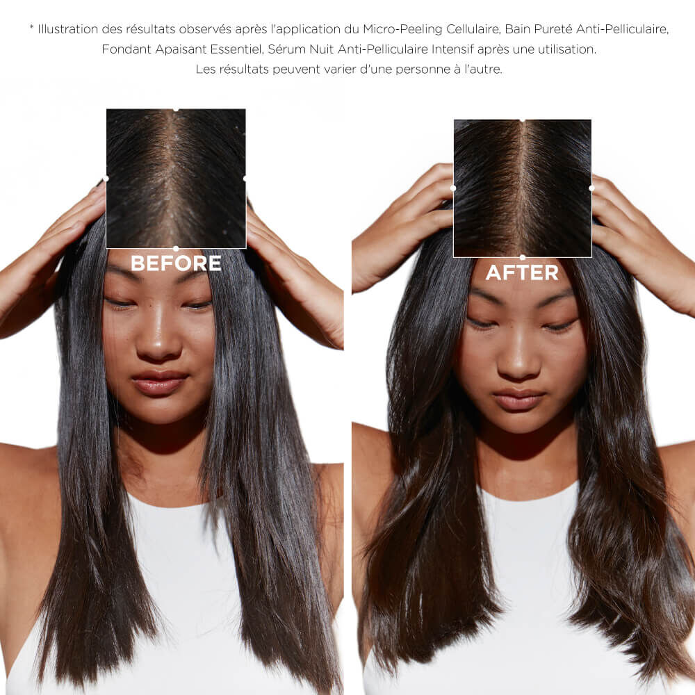 Trio Symbiose anti-pelliculaire cuir chevelu gras